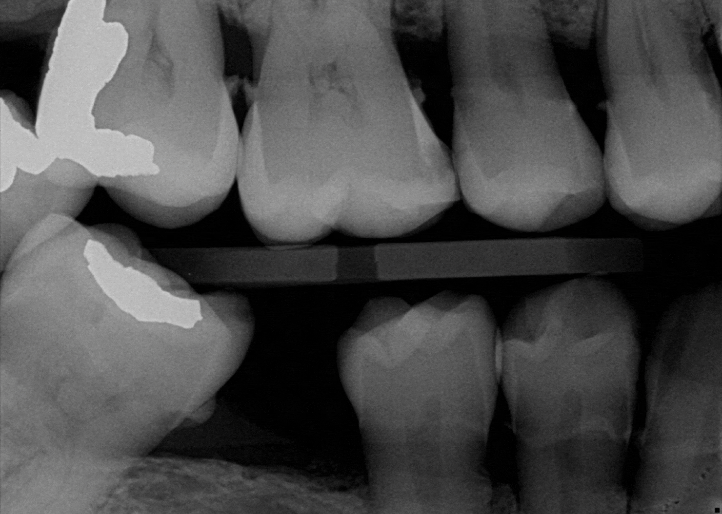 Dental AI Diagnostics for Dentists | Overjet